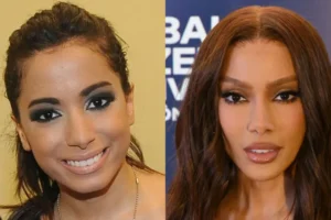 Antes e depois das cirurgias plásticas dos famosos: Os procedimentos que eles fizeram!