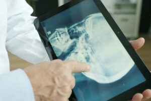 Inteligência Artificial é aliada do médico para conseguir resultados mais precisos e rápidos